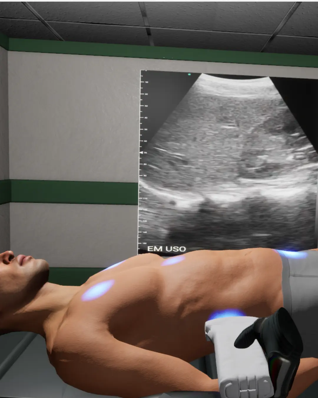 Paciente virtual em maca com janela de ultrassom durante simulação eFAST.