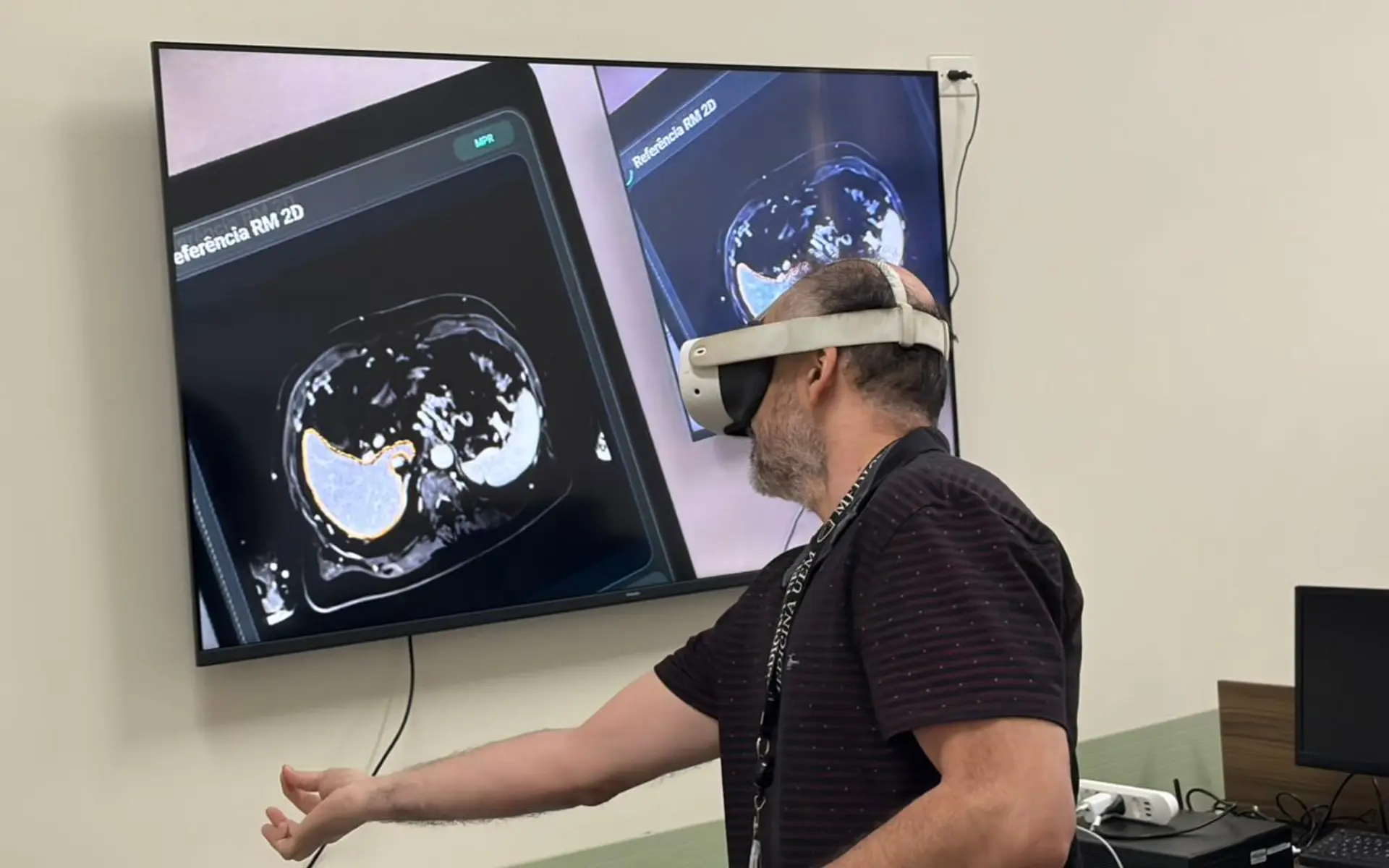 Pessoa utilizando headset de realidade virtual diante de telas com exame de imagem médica e área segmentada.