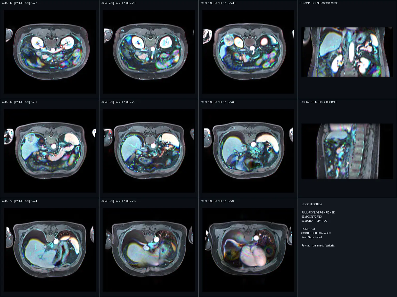 Painel com cortes de imagem médica usados no processo de revisão do OREN.