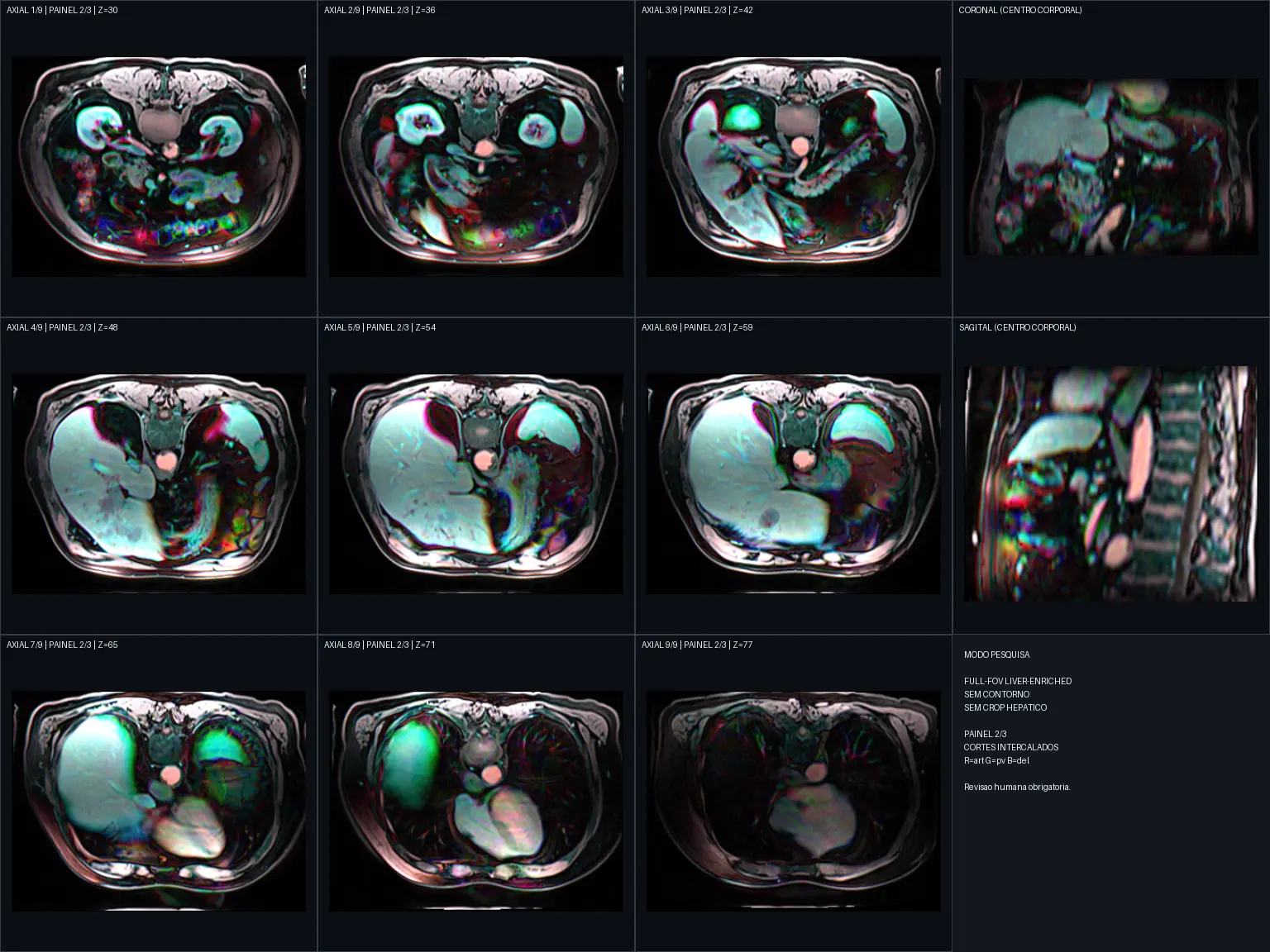 Segundo painel com diferentes cortes de imagem médica para comparação.