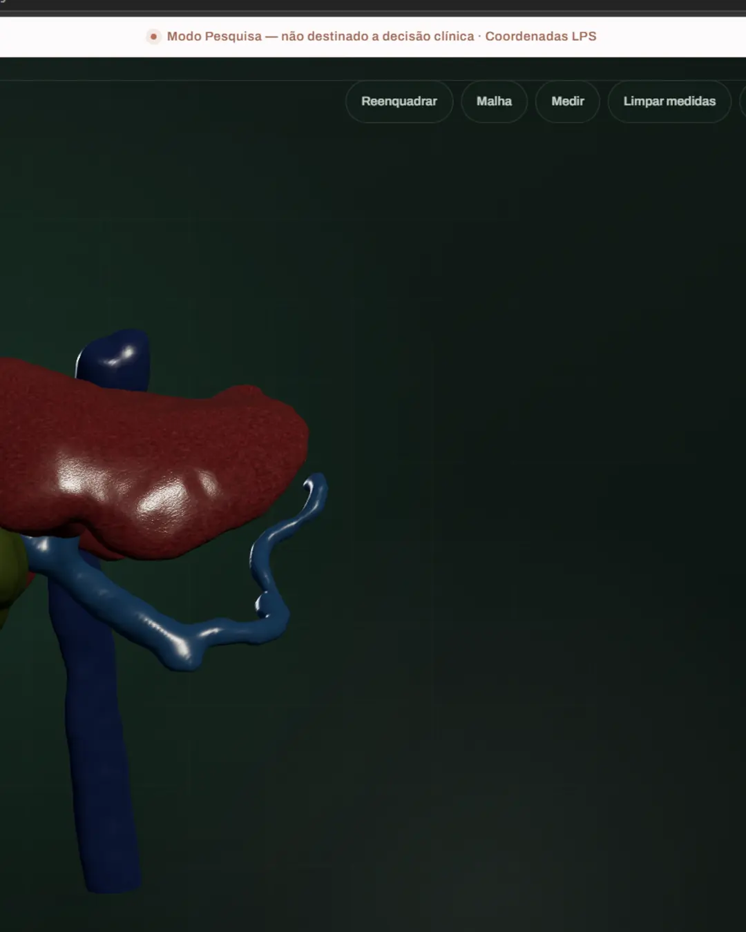 Visualizador OREN exibindo modelo anatômico tridimensional do fígado com acabamento realista e referência de imagem médica.